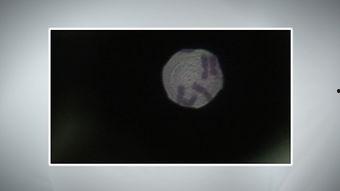 肺触诊视频,视频教学带你轻松掌握